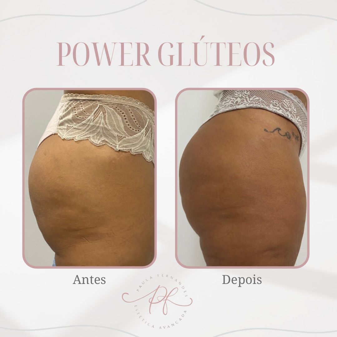 power-gluteo (2) power-gluteo (2)