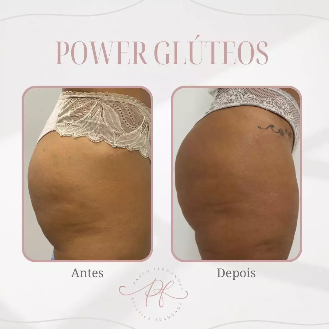 power-gluteo (2) power-gluteo (2)